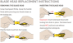 Klever XChange Replacement Blades